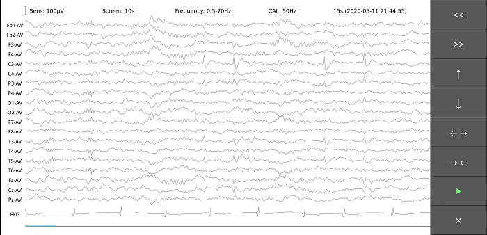EEG browsing