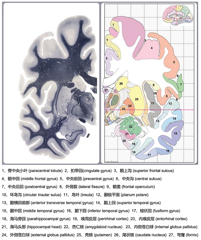 coronal view through hippocampal head