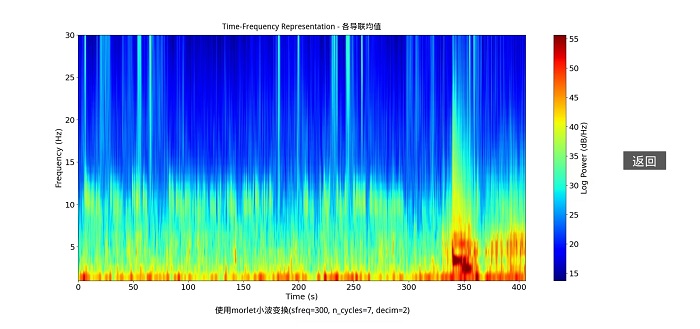 time frequency analysis
